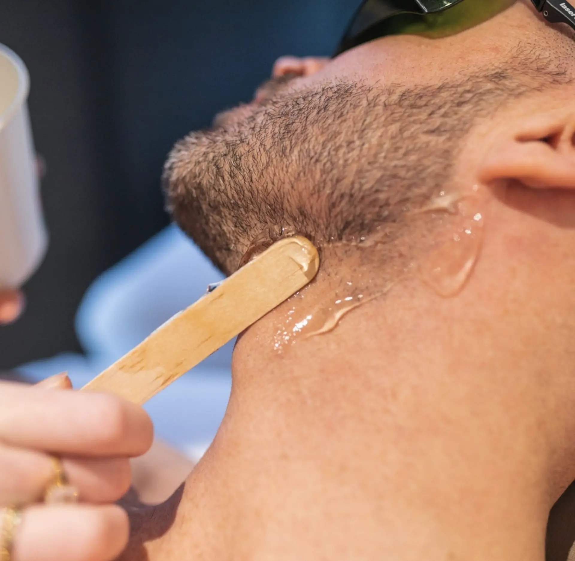 dailysoccerblog | Should Laser Practitioners Learn Male-Specific Techniques? dailysoccerblog | Should Laser Practitioners Learn Male-Specific Techniques?