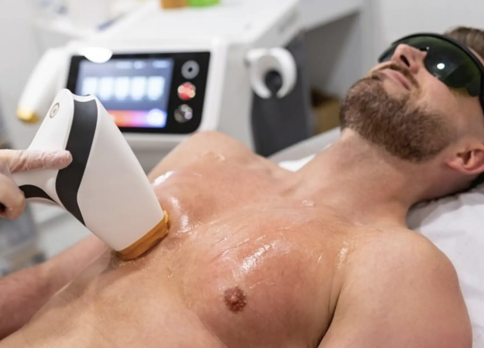 dailysoccerblog | Should Laser Practitioners Learn Male-Specific Techniques? dailysoccerblog | Should Laser Practitioners Learn Male-Specific Techniques?