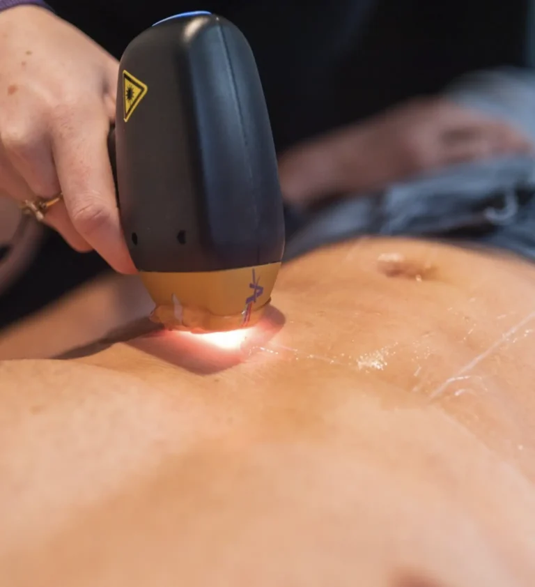 dailysoccerblog|Should Laser Practitioners Learn Male-Specific Techniques?